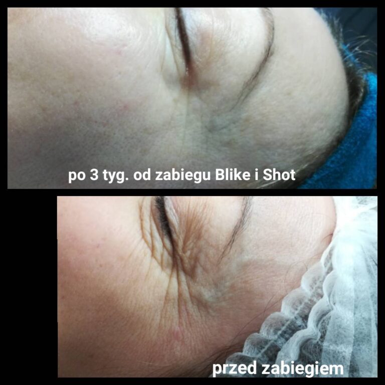 Be like Be shot centrum urody faustyna micał 5