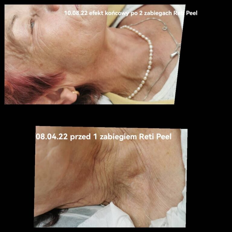 Reti Peel centrum urody faustyna micał